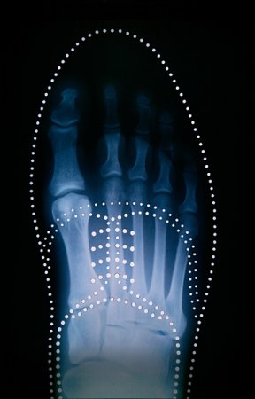 Right shoe (template b) Vrs 2 - Details